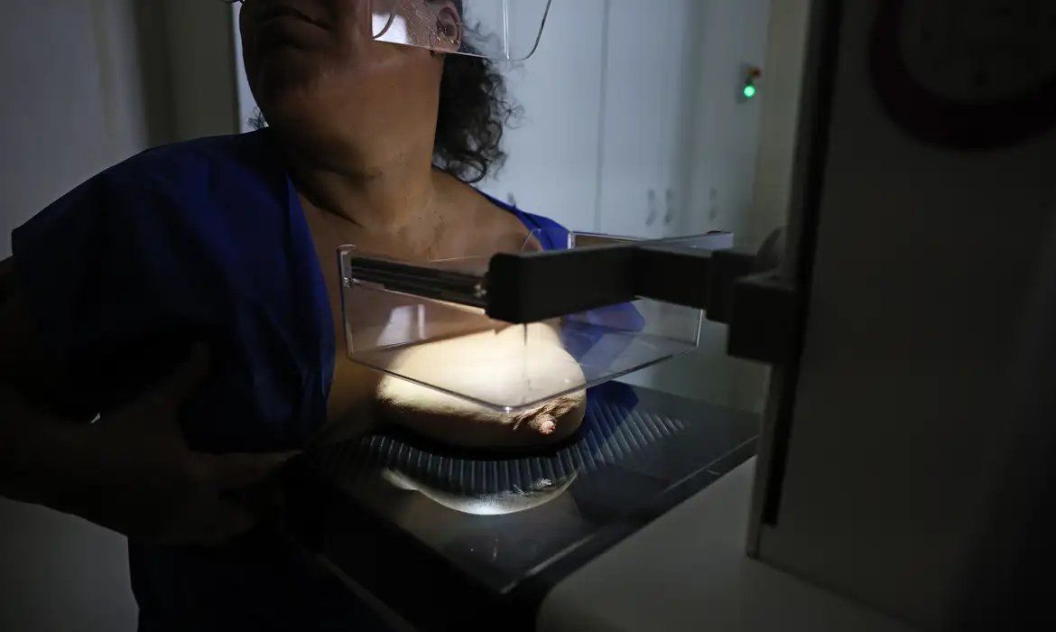 Vigitel: 92% das brasileiras entre 50 e 69 anos fizeram mamografia