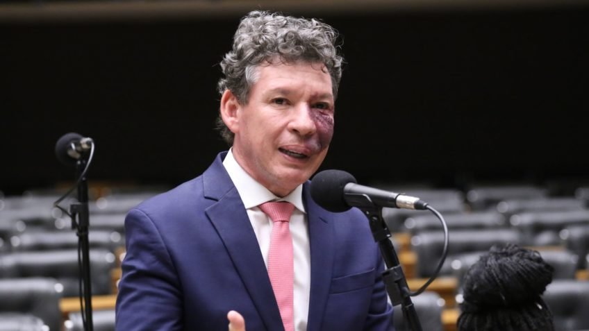 Ser contra o fim da escala 6 X 1 é como defender a escravidão, diz Lopes