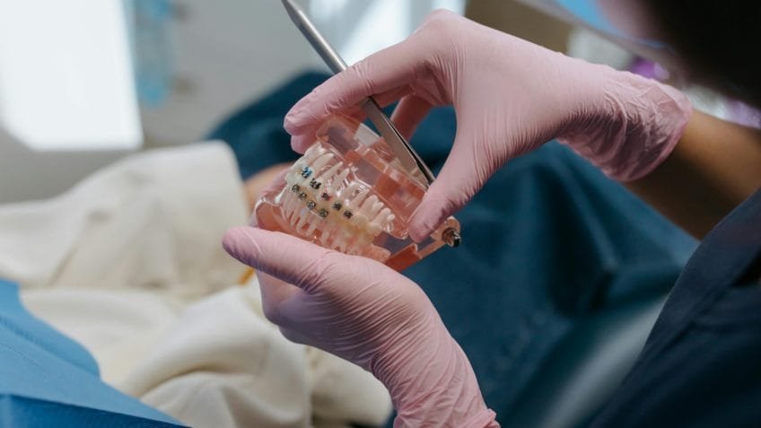 Dentes voltam a entortar depois do uso de aparelho ortodôntico