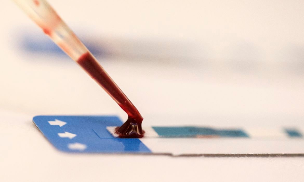 Estudo inédito da Fiocruz pode ampliar prevenção de HIV entre jovens